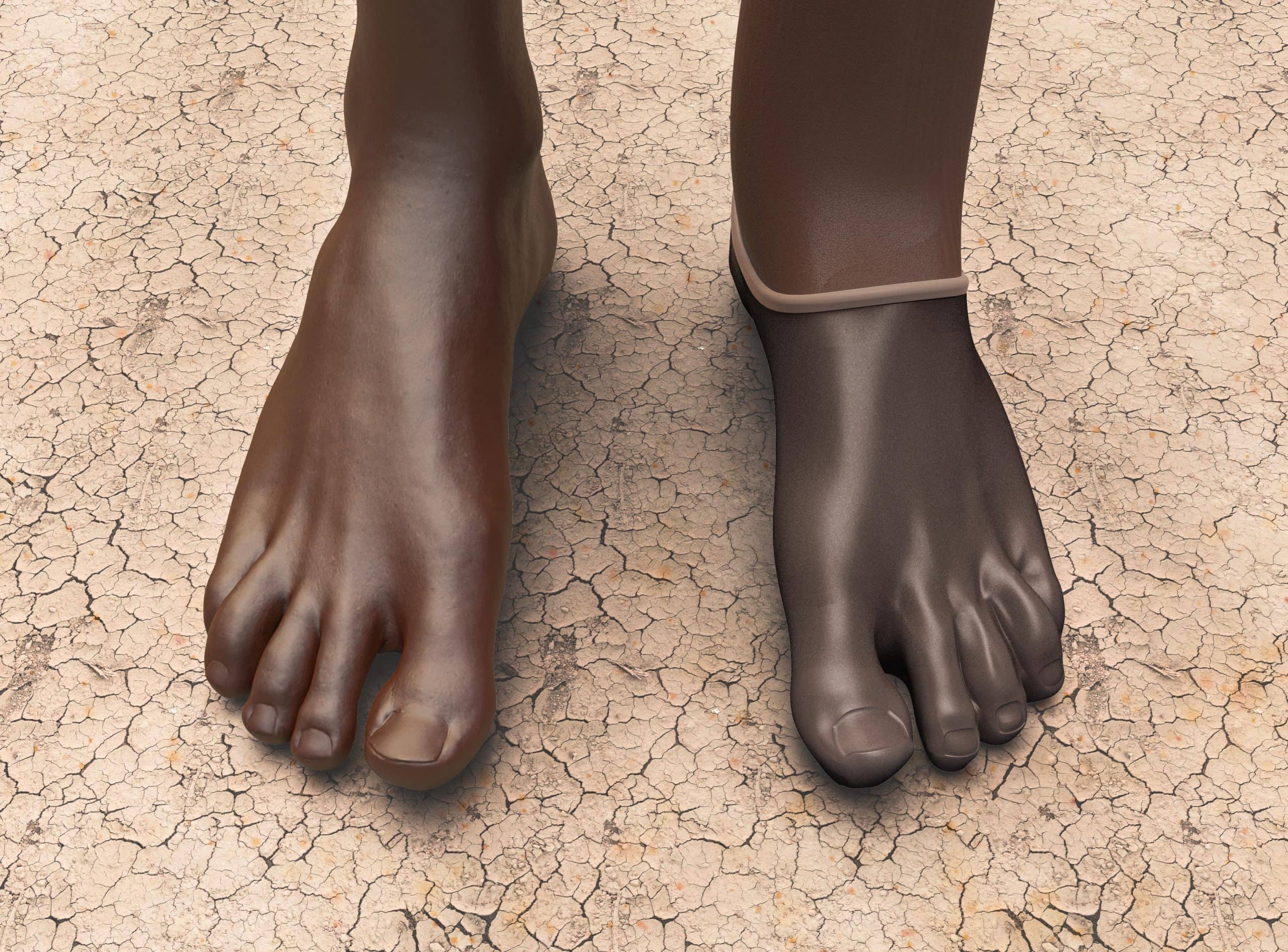 Long Limbs Prosthetics - Cover