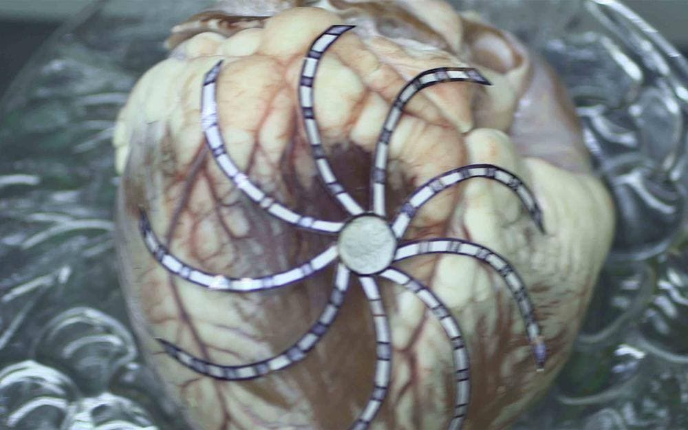 Heart rate stimulation system