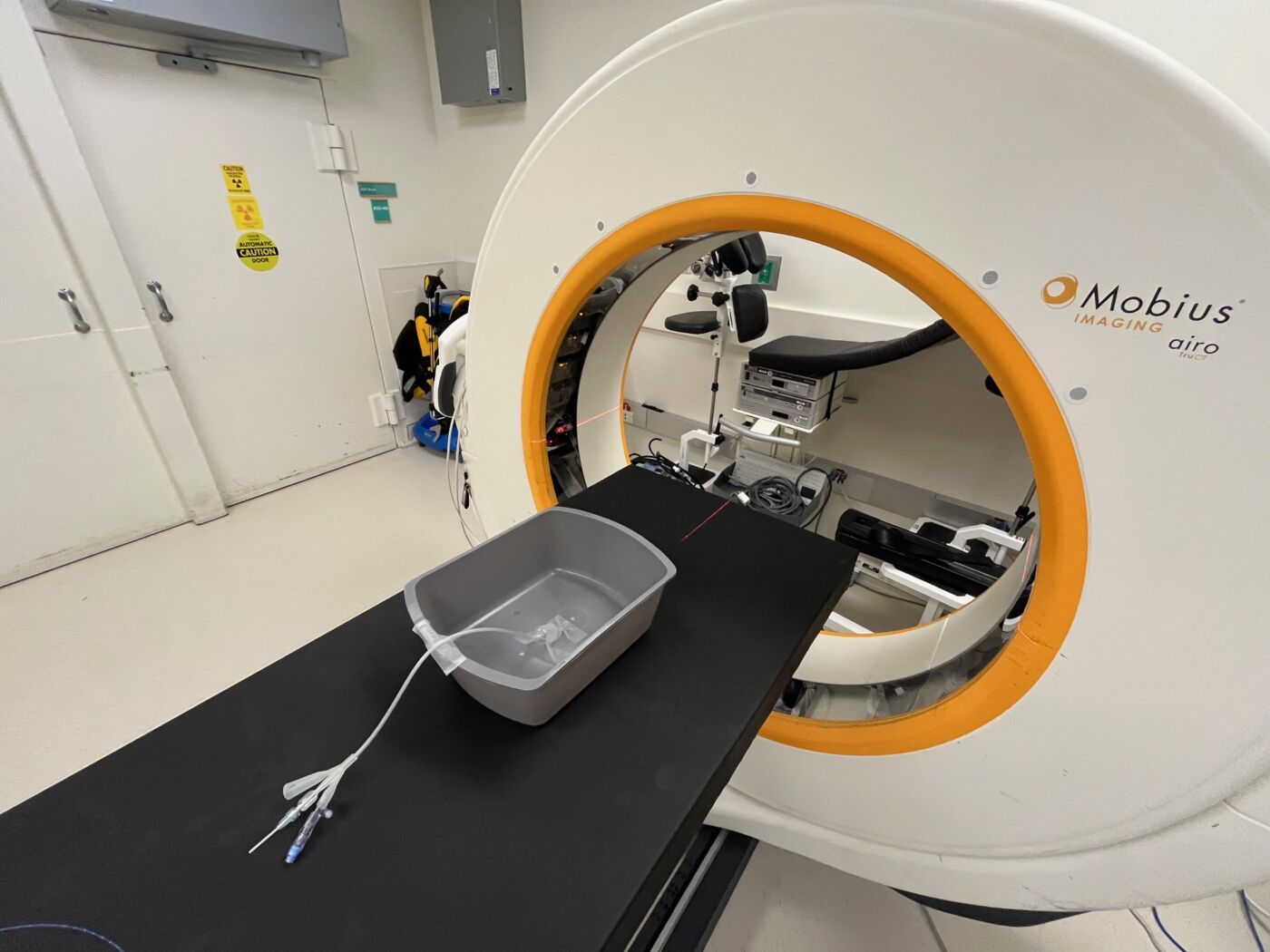 Bladder Cancer Brachytherapy