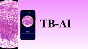 TB-AI